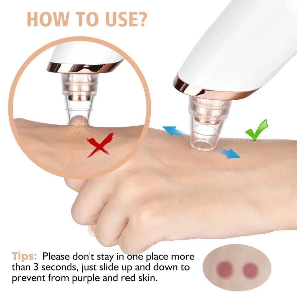 Electric Blackhead Remover with Digital Display | Multi-Tip Pore Cleaning Facial Tool