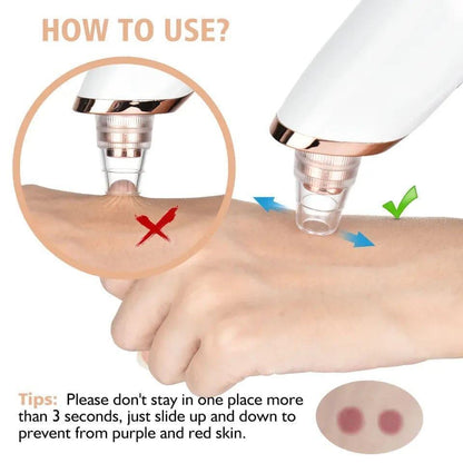 Electric Blackhead Remover with Digital Display | Multi-Tip Pore Cleaning Facial Tool